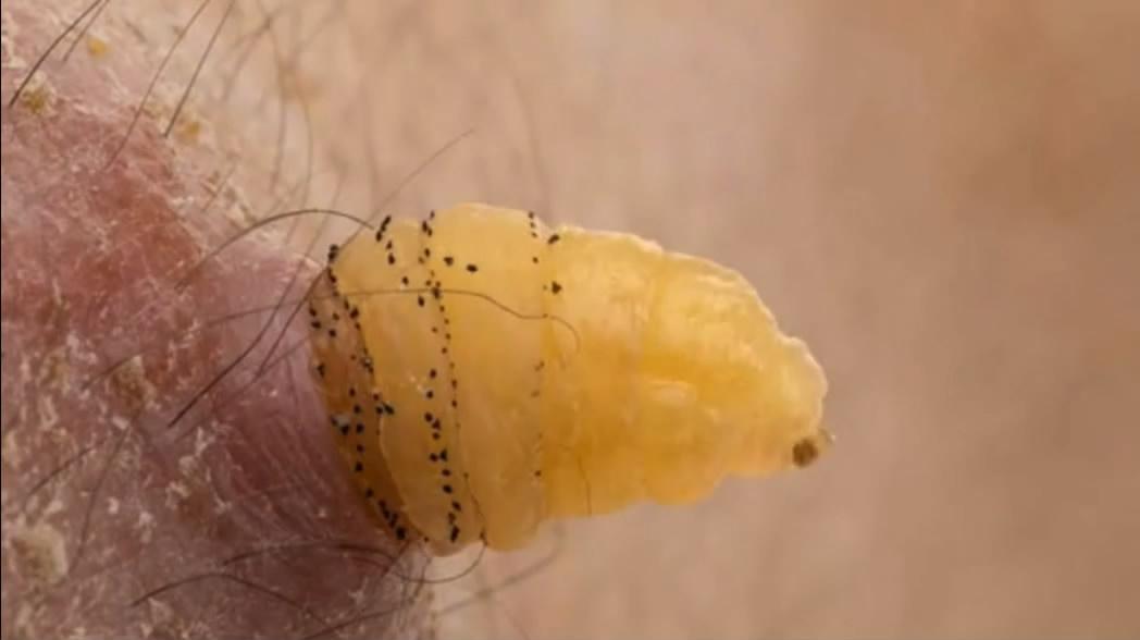 哈佛小哥为科学献身,在自己身体里培育皮肤蝇蛆虫!