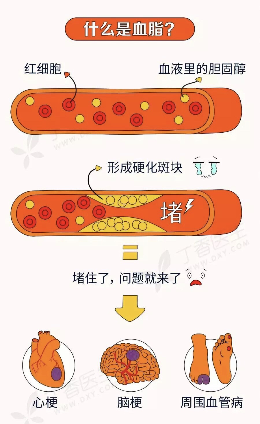 一张图帮你了解血脂,胆固醇