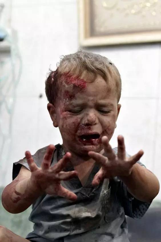 战争儿童伤害图片