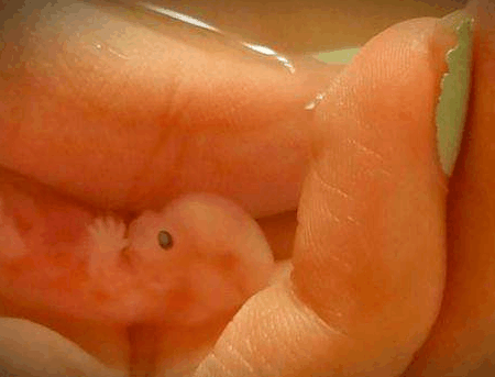 8周流产后的胎儿图片图片