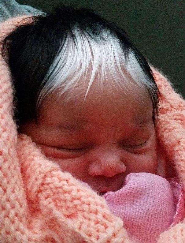 这位美国女婴一出生就拥有一撮神奇的白发,这是怎么回事?