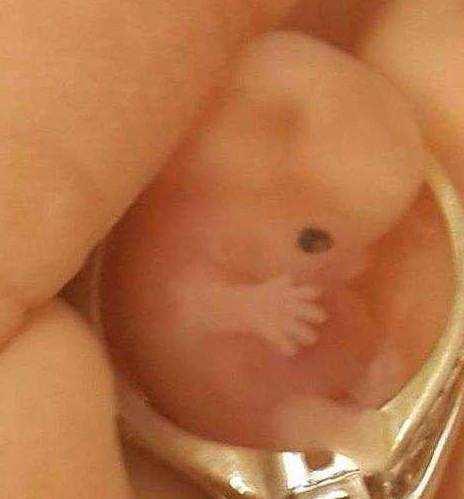 怀孕8周胎儿发育图片图片