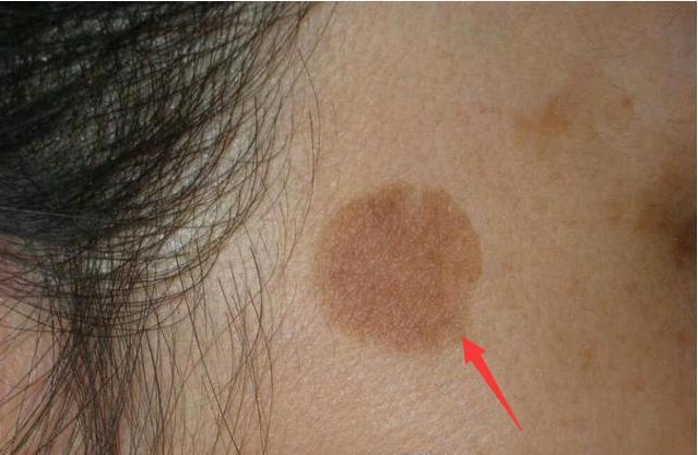 【方法】在芦荟上剪下一块芦荟叶片,洗干净后将皮