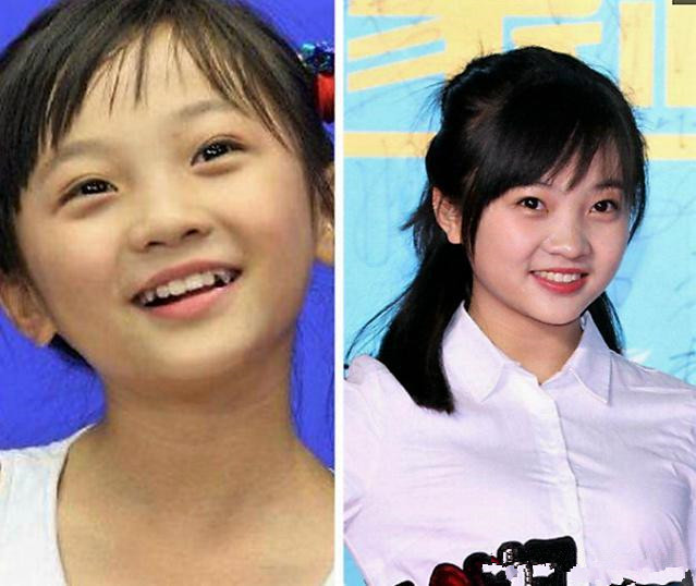 6位小童星今昔对比照,疯狂为王俊凯打call,最后一位确实惊艳!