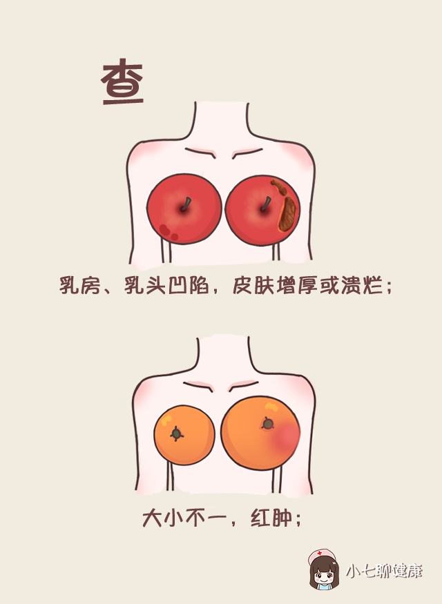 乳腺体格检查图片