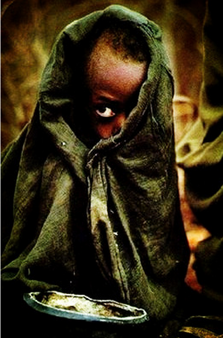 非洲小孩瘦骨如柴图片