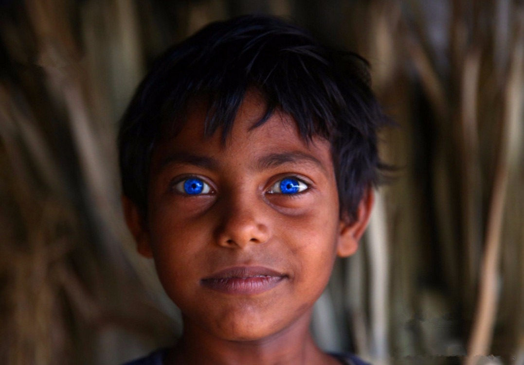 一件好事,许多网友看后都十分羡慕这样的瞳色,但胡克的生活却非常艰辛