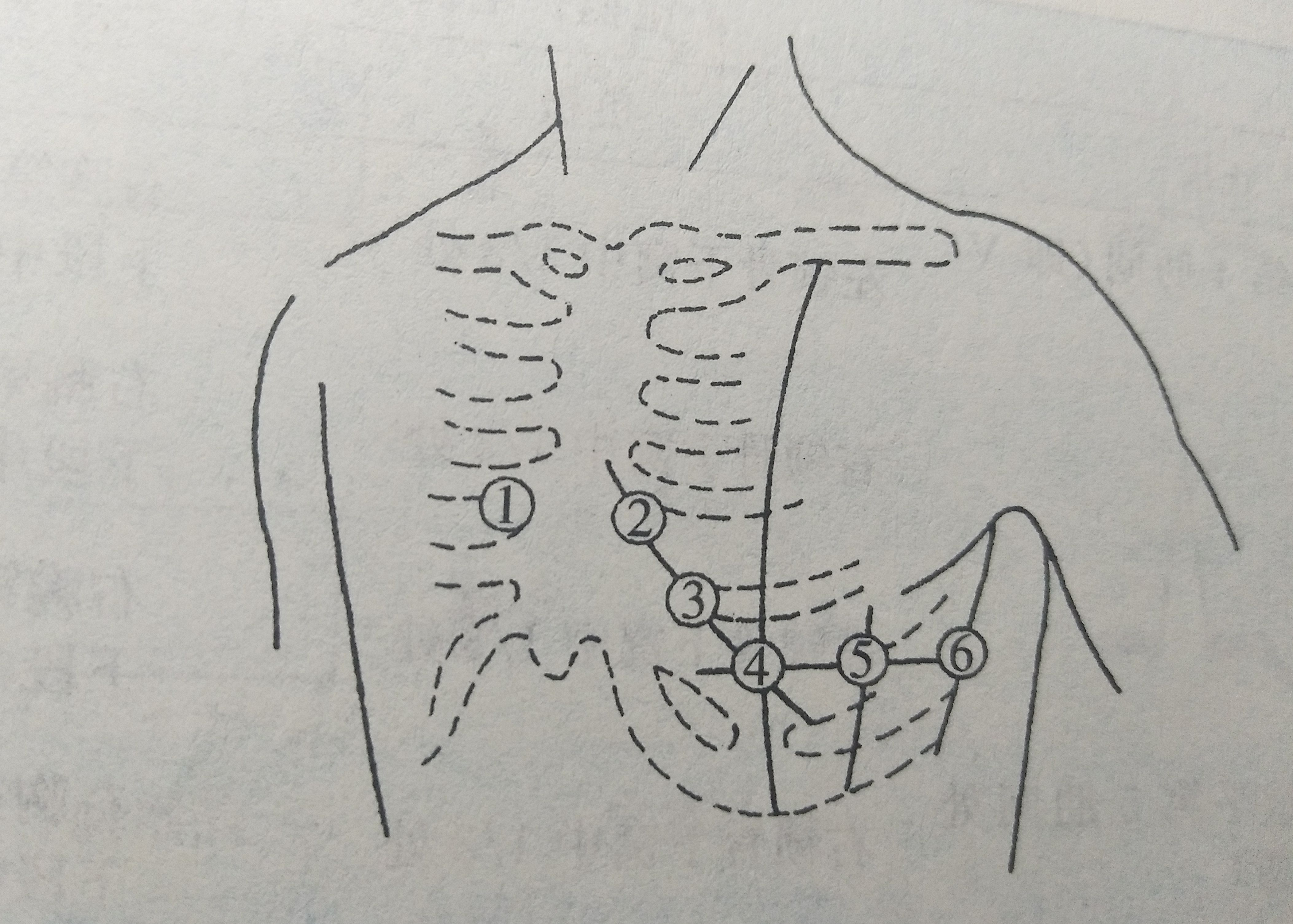 心电图入门须知㈡
