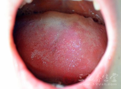 嘴苦是什么病的征兆图片