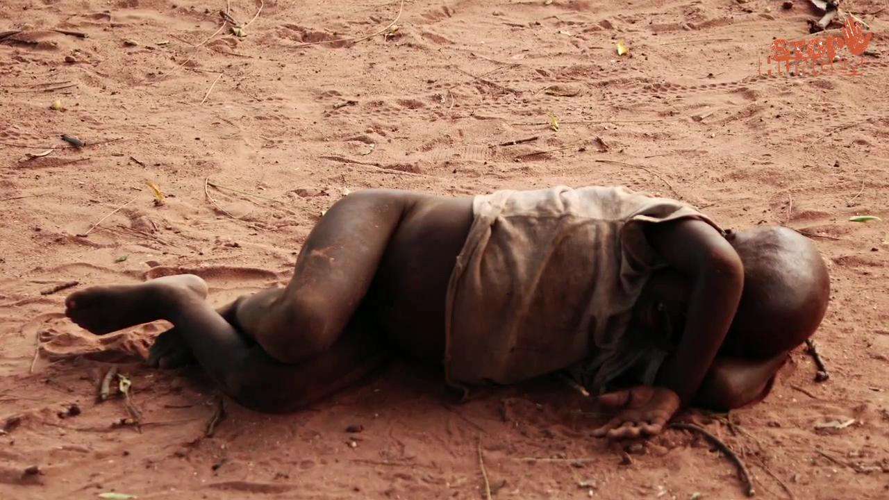非洲挨饿的孩子图片